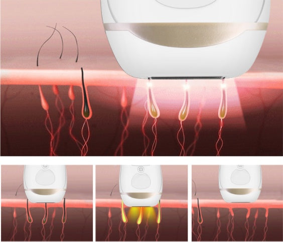 IPL Laser Hair Removal Device - Professional At-Home Permanent Hair Reduction