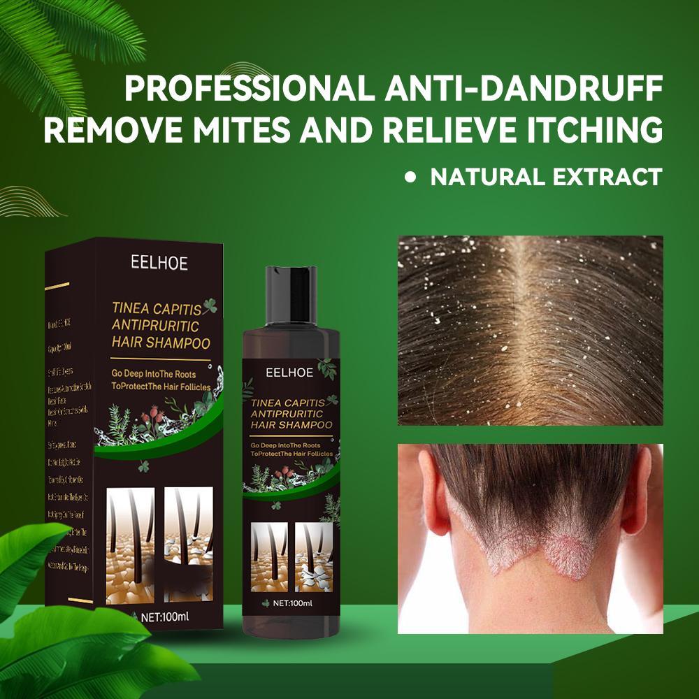 EELHOE Anti-Dandruff Shampoo - Itch Relief & Hair Loss Prevention | Oil Control Formula