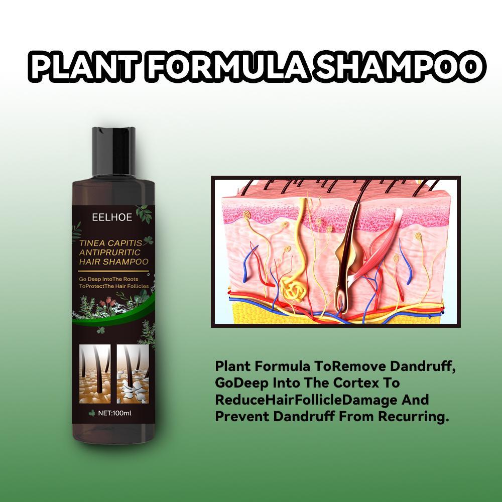 EELHOE Anti-Dandruff Shampoo - Itch Relief & Hair Loss Prevention | Oil Control Formula