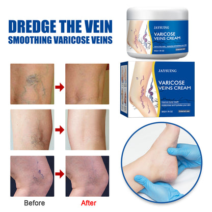 Leg Vein Repair Cream - Varicose Vein Massage Treatment for Spider Veins