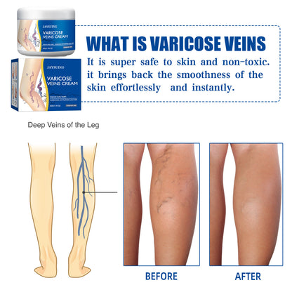 Leg Vein Repair Cream - Varicose Vein Massage Treatment for Spider Veins