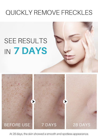 Rose Scent Dark Spot Corrector Cream - Skin Repair & Brightening Treatment