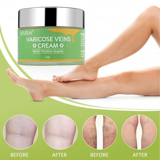 Varicose Vein Cream - Safflower Relief for Spider Veins & Leg Bruises